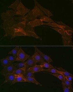 Sodium Potassium ATPase Alpha 1 Rabbit anti-Human, Mouse, Rat, Clone: 3L6F0,