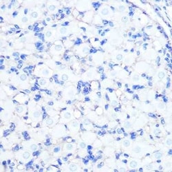 Sodium Potassium ATPase Alpha 1 Rabbit anti-Human, Mouse, Rat, Clone: 3L6F0,