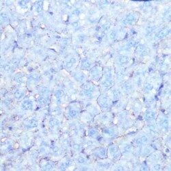 Sodium Potassium ATPase Alpha 1 Rabbit anti-Human, Mouse, Rat, Clone: 3L6F0,