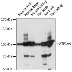 Sodium Potassium ATPase Alpha 4 Antibody - Azide and BSA Free, Novus Biologicals:Antibodies:Primary