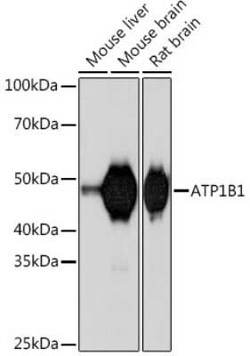 Sodium Potassium ATPase Beta 1 Rabbit anti-Human, Mouse, Rat, Clone: 4M5T3,