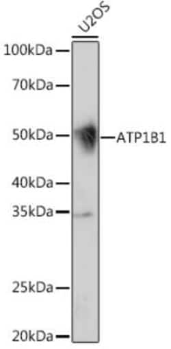 Sodium Potassium ATPase Beta 1 Rabbit anti-Human, Mouse, Rat, Clone: 4M5T3,