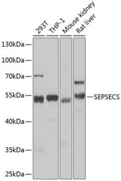 Soluble Liver/Pancreas Antigen Antibody - BSA Free, Novus Biologicals 0.1