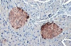Somatostatin Antibody (HL1101), Novus Biologicals 100 &mu;g; Unconjugated:Antibodies,