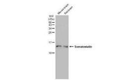 Somatostatin Antibody (HL1101), Novus Biologicals 100 &mu;g; Unconjugated:Antibodies,