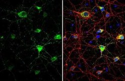 Somatostatin Antibody, Novus Biologicals 100 &mu;g | Buy Online | Novus Biologicals | Fisher Scientific