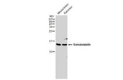 Somatostatin Antibody, Novus Biologicals 100 &mu;g | Buy Online | Novus Biologicals | Fisher Scientific