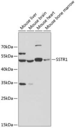 Somatostatin R1/SSTR1 Antibody - Azide and BSA Free, Novus Biologicals:Antibodies:Primary