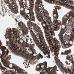 Somatostatin R2/SSTR2 Antibody, Novus Biologicals:Antibodies:Primary Antibodies