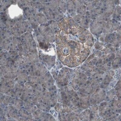 Somatostatin R2/SSTR2 Antibody, Novus Biologicals:Antibodies:Primary Antibodies