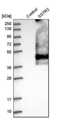 Somatostatin R2/SSTR2 Antibody, Novus Biologicals:Antibodies:Primary Antibodies