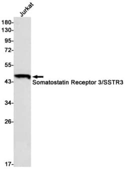 Somatostatin R3/SSTR3 Antibody (S08-2G8), Novus Biologicals 100 &mu;g;