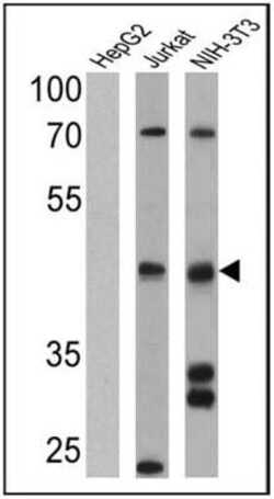 Somatostatin R4/SSTR4 Antibody, Novus Biologicals 100 &mu;L | Buy Online | Novus Biologicals | Fisher Scientific