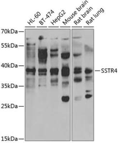 Somatostatin R4/SSTR4 Antibody - BSA Free, Novus Biologicals:Antibodies:Primary