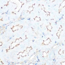 Somatostatin R5/SSTR5 Rabbit anti-Human, Mouse, Rat, Clone: 4O6N5, Novus Biologicals 20 &mu;g | Buy Online | Novus Biologicals | Fisher Scientific