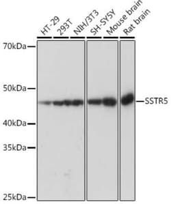 Somatostatin R5/SSTR5 Rabbit anti-Human, Mouse, Rat, Clone: 4O6N5, Novus Biologicals 20 &mu;g | Buy Online | Novus Biologicals | Fisher Scientific