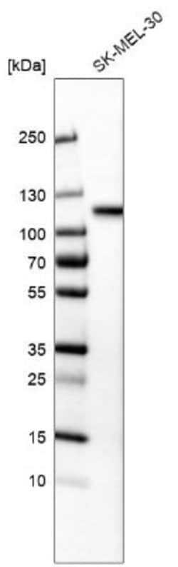 Sortilin Antibody (CL6528), Novus Biologicals Sortilin Antibody; Unconjugated;