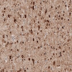 Sortilin Antibody (CL6528), Novus Biologicals Sortilin Antibody; Unconjugated;