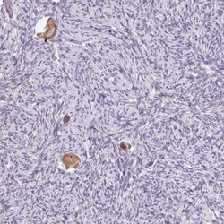 Sorting Nexin 31 Antibody, Novus Biologicals 25 &mu;L, Unconjugated:Antibodies,
