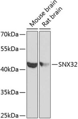Sorting Nexin 32 Antibody - BSA Free, Novus Biologicals:Antibodies:Primary