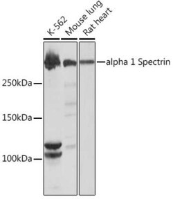 Spectrin alpha 1 Rabbit anti-Human, Mouse, Rat, Clone: 1U5K4, Novus Biologicals 20 &mu;g | Buy Online | Novus Biologicals | Fisher Scientific