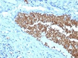 Spectrin alpha 1, Mouse anti-Human, Clone: SPTA1/1832, Novus Biologicals:Antibodies:Primary