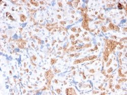 Spectrin alpha 1 Antibody (rSPTA1/1832) - Azide and BSA Free, Novus Biologicals 100 &mu;g | Buy Online | Novus Biologicals | Fisher Scientific