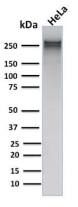 Spectrin alpha 1 Mouse anti-Human, Clone: rSPTA1/1832, Novus Biologicals:Antibodies:Primary