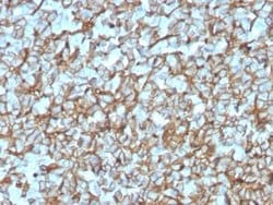 Spectrin beta 3 Antibody (SPTBN2/3142R) - Azide and BSA Free, Novus Biologicals 100 &mu;g | Buy Online | Novus Biologicals | Fisher Scientific