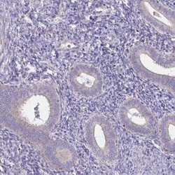 Spectrin beta 3 Antibody, Novus Biologicals 25 &mu;L, Unconjugated:Antibodies,