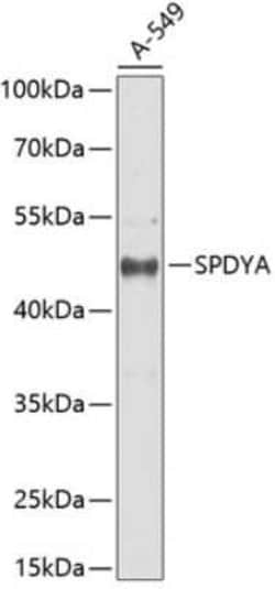 Speedy/Ringo Antibody - BSA Free, Novus Biologicals 0.1 mL; Unconjugated:Antibodies,