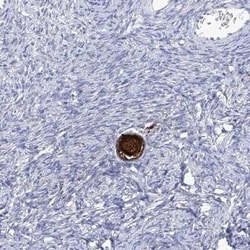 Spermine synthase Antibody, Novus Biologicals 0.1 mL; Unconjugated:Antibodies,