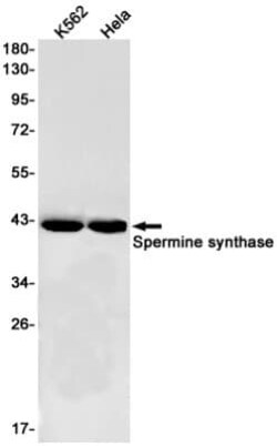 Spermine synthase Antibody (S05-5J5), Novus Biologicals 100 &mu;g | Buy Online | Novus Biologicals | Fisher Scientific