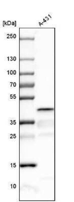 Spermine synthase Antibody, Novus Biologicals 0.1 mL; Unconjugated:Antibodies,