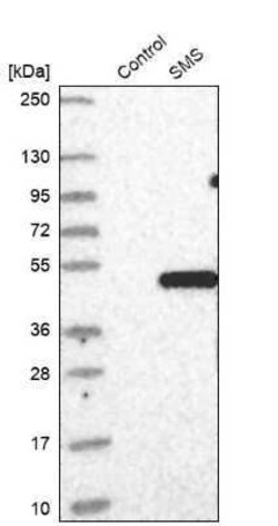Spermine synthase Antibody, Novus Biologicals 0.1 mL; Unconjugated:Antibodies,