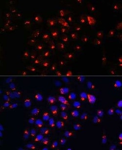 Sphingomyelin synthase 1 Antibody - Azide and BSA Free, Novus Biologicals