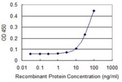 Spinesin Antibody (2E5), Novus Biologicals 0.1 mg | Buy Online | Novus Biologicals | Fisher Scientific
