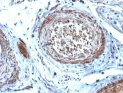 StAR Mouse anti-Human, Clone: STAR/2077, Novus Biologicals:Antibodies:Primary