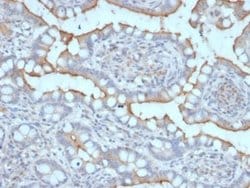 StAR Mouse anti-Human, Clone: STAR/2077, Novus Biologicals:Antibodies:Primary