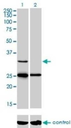 StAR Antibody (5F9), Novus Biologicals 0.1 mg | Buy Online | Novus Biologicals | Fisher Scientific