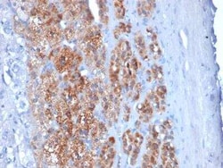 StAR Antibody (STAR/2154), Novus Biologicals 100 &mu;g; Unconjugated:Antibodies,