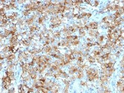 StAR Antibody (STAR/2154), Novus Biologicals 100 &mu;g; Unconjugated:Antibodies,