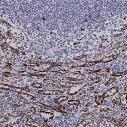 Stabilin-2 Rabbit anti-Human, Polyclonal, Novus Biologicals 25 &mu;g; Unconjugated:Antibodies,