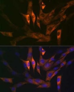 Stathmin 1 Rabbit anti-Human, Mouse, Rat, Clone: 7Y7H4, Novus Biologicals