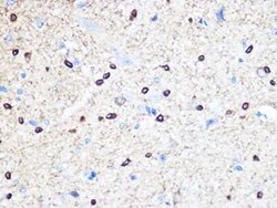 Stathmin 1 Rabbit anti-Human, Mouse, Rat, Clone: 7Y7H4, Novus Biologicals