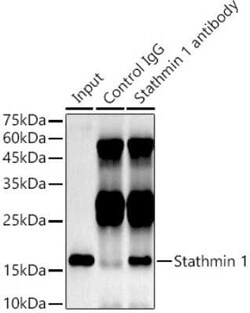 Stathmin 1 Rabbit anti-Human, Mouse, Rat, Clone: 7Y7H4, Novus Biologicals