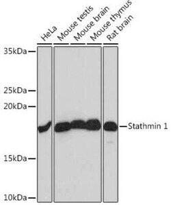 Stathmin 1 Rabbit anti-Human, Mouse, Rat, Clone: 7Y7H4, Novus Biologicals