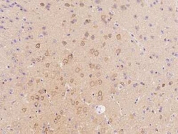 Stathmin 1 Antibody, Novus Biologicals 100 &mu;g; Unconjugated:Antibodies,