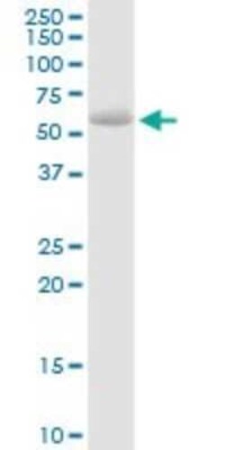 Steroid sulfatase Antibody, Novus Biologicals 0.1 mg | Buy Online | Novus Biologicals | Fisher Scientific