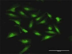Stomatin Antibody, Novus Biologicals 0.1 mg, Unconjugated:Antibodies, Polyclonal